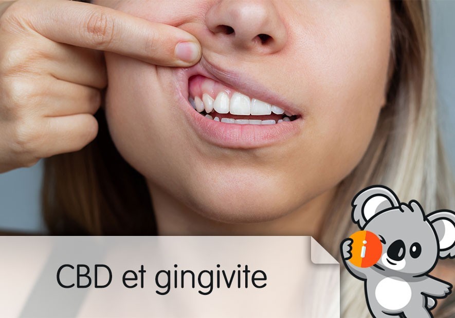 CBD et gingivite, parodontite : avis effet traitement naturel douleurs dentaires
